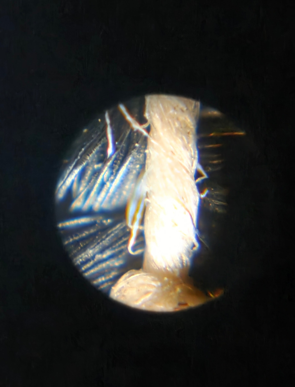 100× magnified stitching