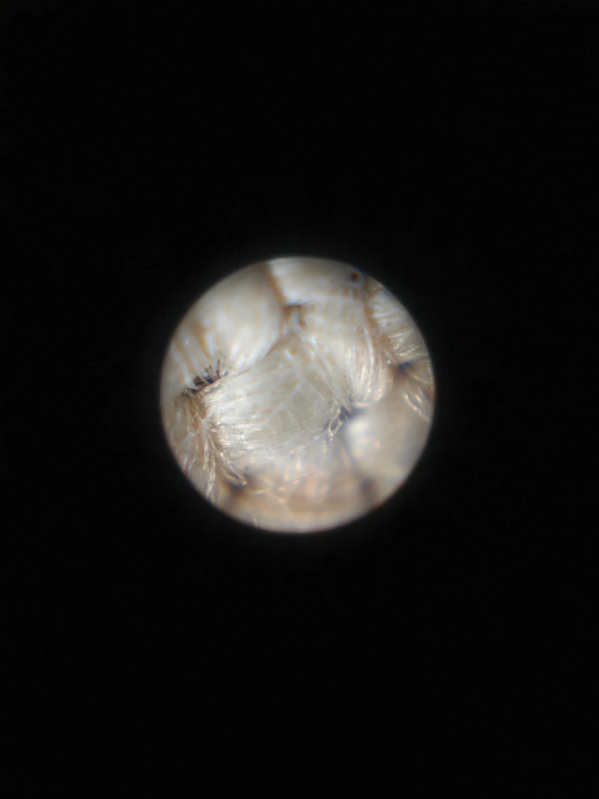 100× magnified view of cotton tape fibres